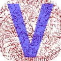 Vibrometer